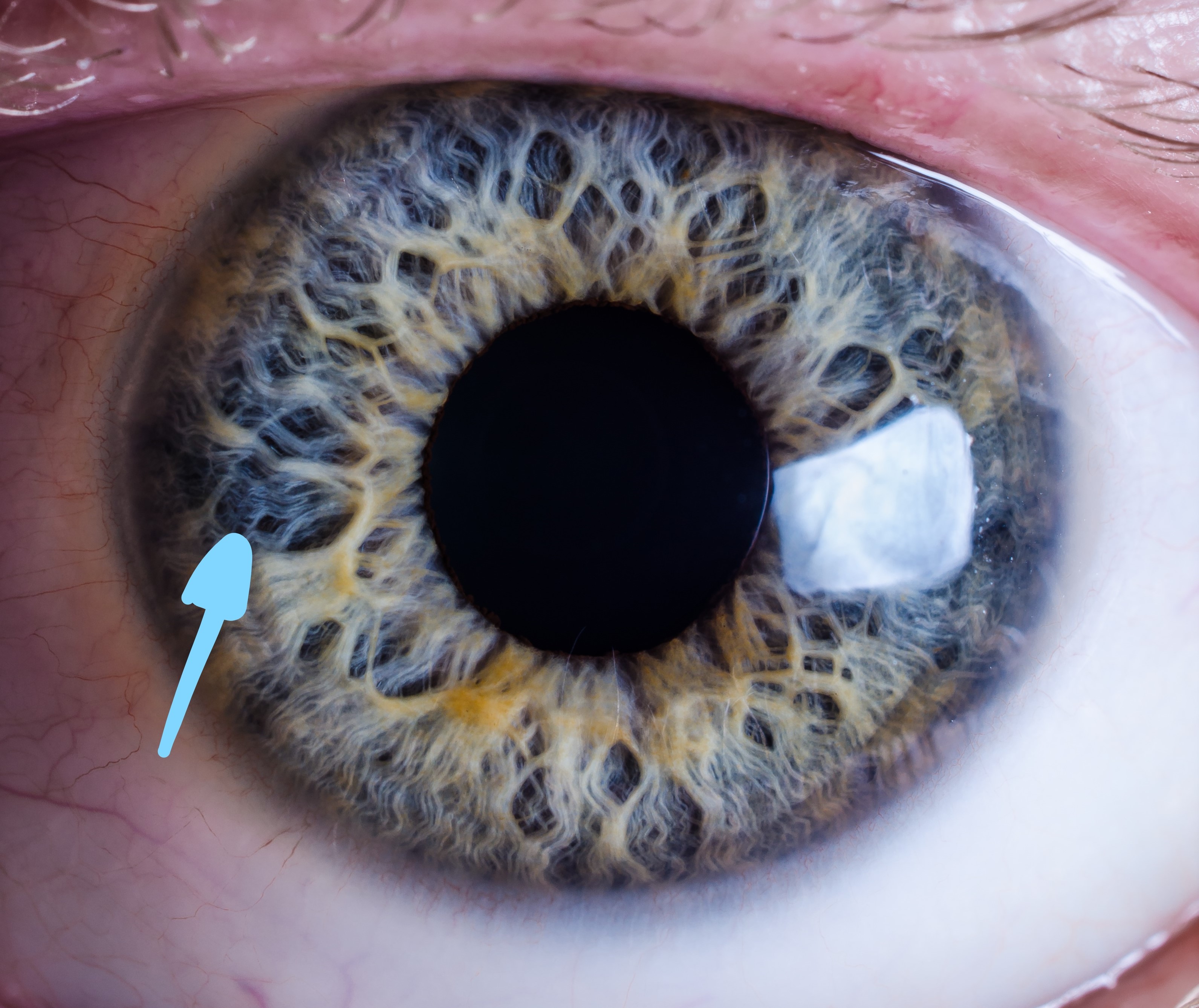 Inkediris trame_LI.jpg